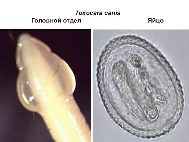 Toxocara canis Головной отдел Яйцо