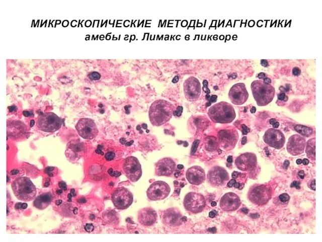 МИКРОСКОПИЧЕСКИЕ МЕТОДЫ ДИАГНОСТИКИ амебы гр. Лимакс в ликворе