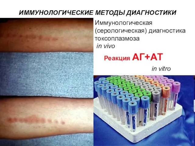 ИММУНОЛОГИЧЕСКИЕ МЕТОДЫ ДИАГНОСТИКИ Иммунологическая (серологическая) диагностика токсоплазмоза in vivo in vitro Реакция АГ+АТ