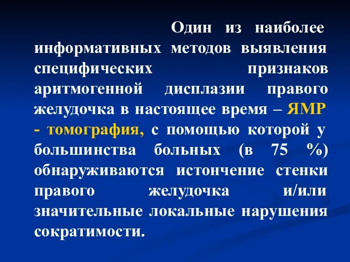 Один из наиболее информативных методов выявления специфических признаков аритмогенной дисплазии