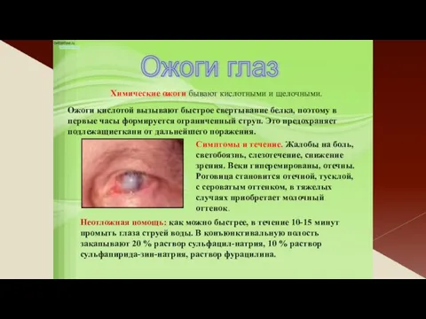 Ожоги глаз Химические ожоги бывают кислотными и щелочными. Симптомы и