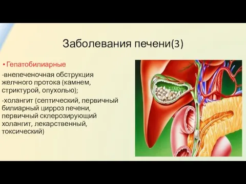 Заболевания печени(3) Гепатобилиарные -внепеченочная обструкция желчного протока (камнем, стриктурой, опухолью); -холангит (септический, первичный