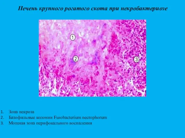 Печень крупного рогатого скота при некробактериозе Зона некроза Базофильные колонии Fusobacterium necrophorum Мощная зона перифокального воспаления
