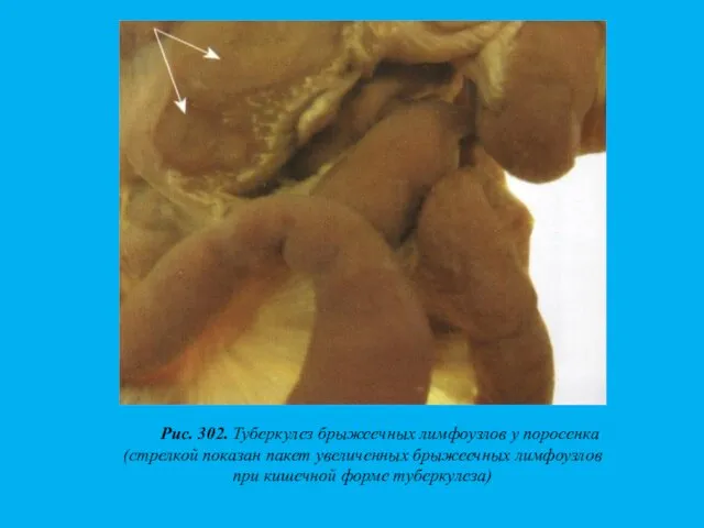 Рис. 302. Туберкулез брыжеечных лимфоузлов у поросенка (стрелкой показан пакет увеличенных брыжеечных лимфоузлов
