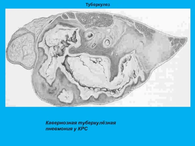 Туберкулез Кавернозная туберкулёзная пневмония у КРС