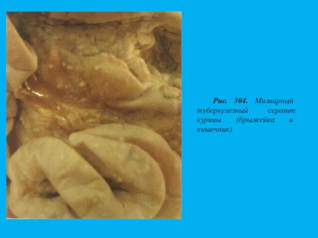 Рис. 304. Милиарный туберкулезный серозит курицы (брыжейка и кишечник)