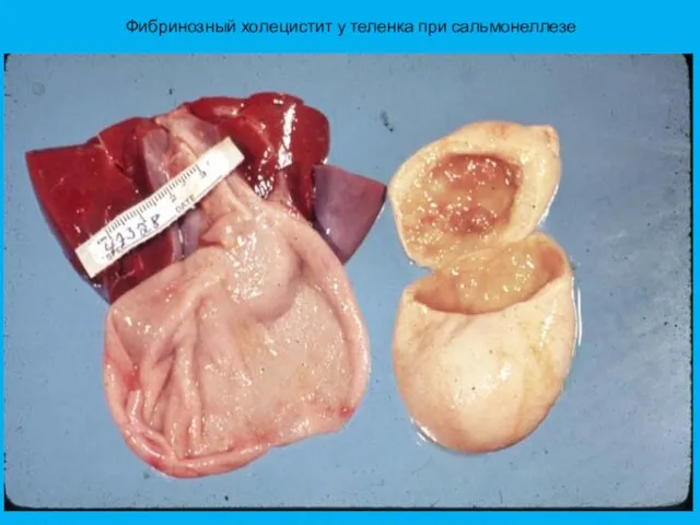 Фибринозный холецистит у теленка при сальмонеллезе