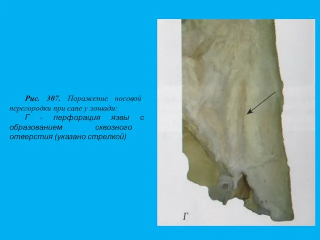 Рис. 307. Поражение носовой перегородки при сапе у лошади: Г