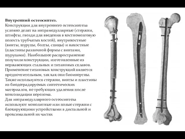 Внутренний остеосинтез. Конструкции для внутреннего остеосинтеза условно делят на интрамедуллярные