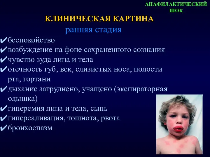 АНАФИЛАКТИЧЕСКИЙ ШОК ранняя стадия беспокойство возбуждение на фоне сохраненного сознания чувство зуда лица