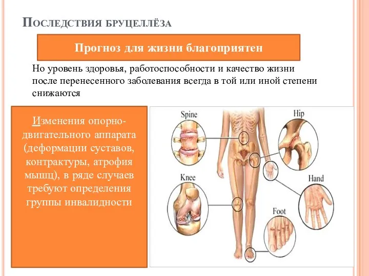 Последствия бруцеллёза Но уровень здоровья, работоспособности и качество жизни после