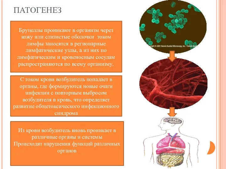 ПАТОГЕНЕЗ Бруцеллы проникают в организм через кожу или слизистые оболочки