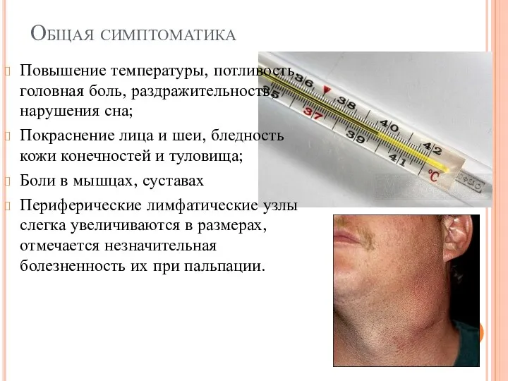 Повышение температуры, потливость, головная боль, раздражительность, нарушения сна; Покраснение лица