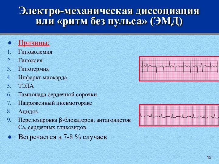Электро-механическая диссоциация или «ритм без пульса» (ЭМД) Причины: Гиповолемия Гипоксия Гипотермия Инфаркт миокарда