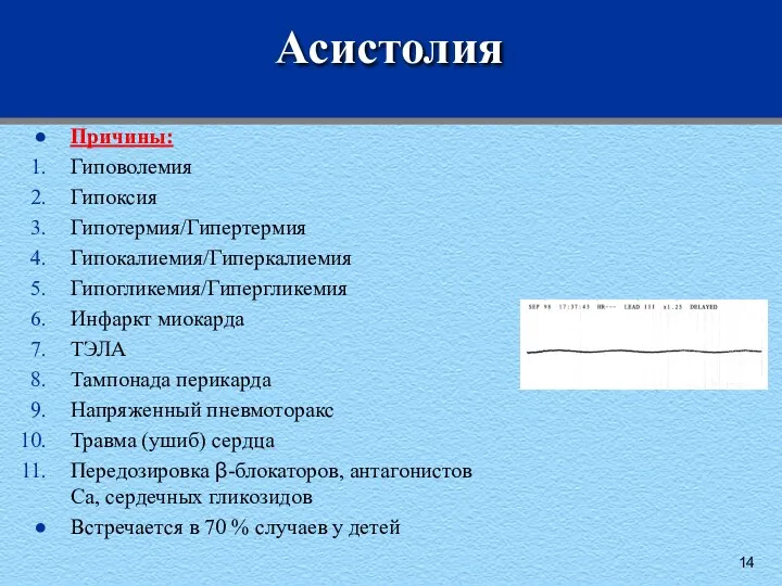 Асистолия Причины: Гиповолемия Гипоксия Гипотермия/Гипертермия Гипокалиемия/Гиперкалиемия Гипогликемия/Гипергликемия Инфаркт миокарда ТЭЛА