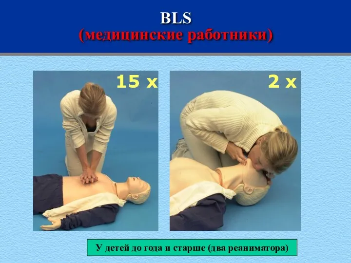 BLS (медицинские работники) 15 x 2 x У детей до года и старше (два реаниматора)