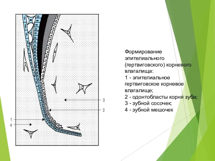 Формирование эпителиального (гертвиговского) корневого влагалища: 1 - эпителиальное гертвиговское корневое влагалище; 2 -