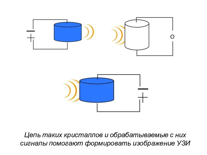 Цепь таких кристаллов и обрабатываемые с них сигналы помогают формировать изображение УЗИ