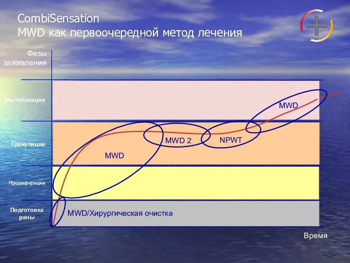 CombiSensation MWD как первоочередной метод лечения Время Фазы заживления Подготовка раны Пролиферация Грануляция Эпителизация