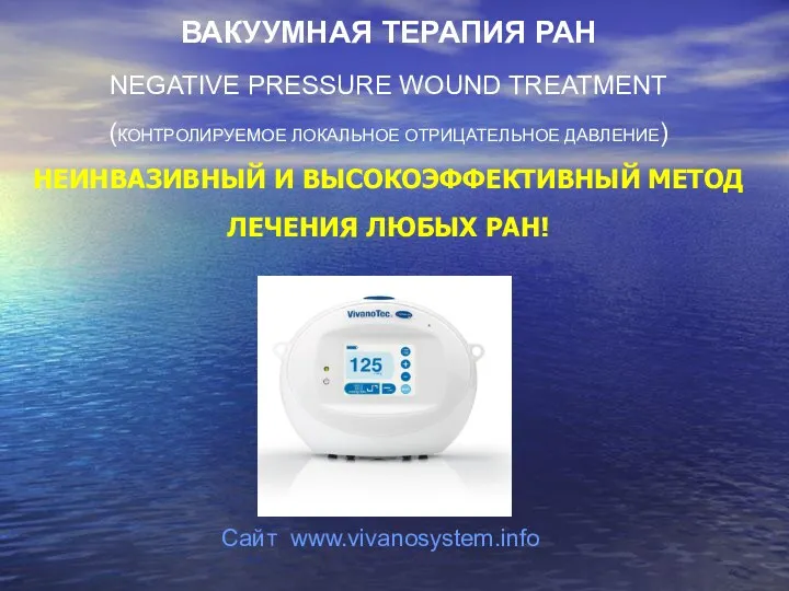 ВАКУУМНАЯ ТЕРАПИЯ РАН NEGATIVE PRESSURE WOUND TREATMENT (КОНТРОЛИРУЕМОЕ ЛОКАЛЬНОЕ ОТРИЦАТЕЛЬНОЕ