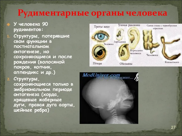 У человека 90 рудиментов: Структуры, потерявшие свои функции в постнатальном онтогенезе, но сохраняющиеся