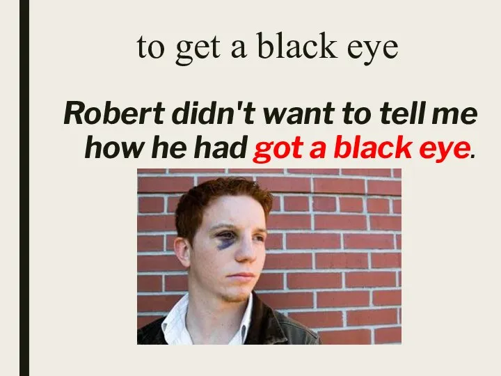 to get a black eye Robert didn't want to tell