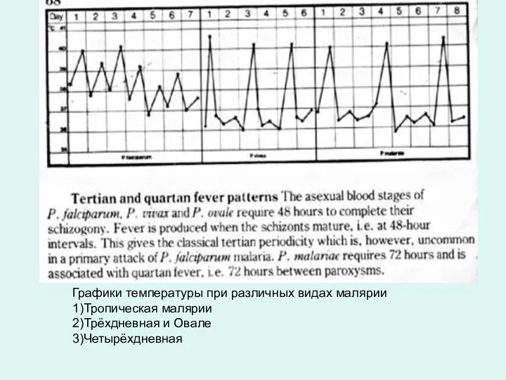 Графики температуры при различных видах малярии 1)Тропическая малярии 2)Трёхдневная и Овале 3)Четырёхдневная