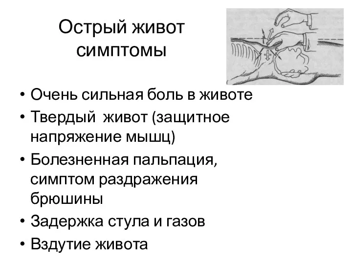 Острый живот симптомы Очень сильная боль в животе Твердый живот