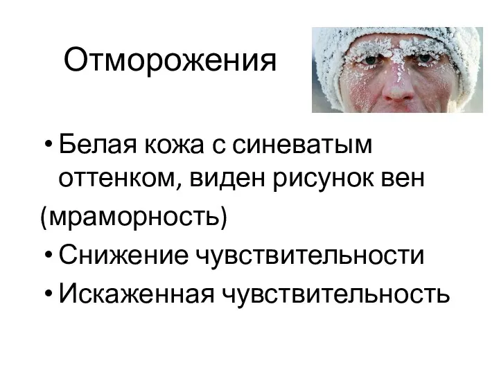 Отморожения Белая кожа с синеватым оттенком, виден рисунок вен (мраморность) Снижение чувствительности Искаженная чувствительность