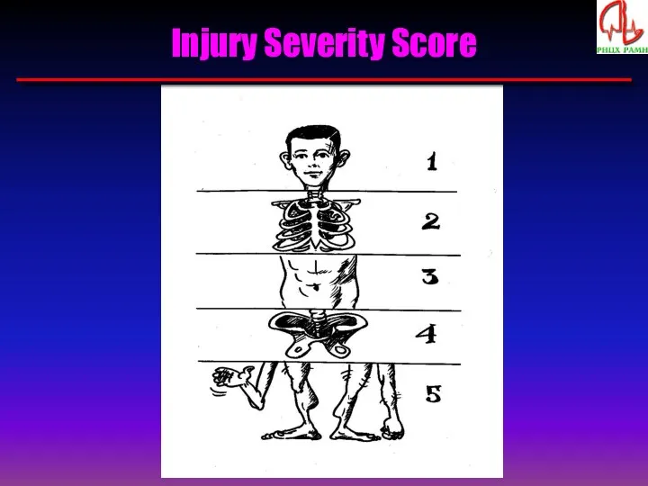 Injury Severity Score