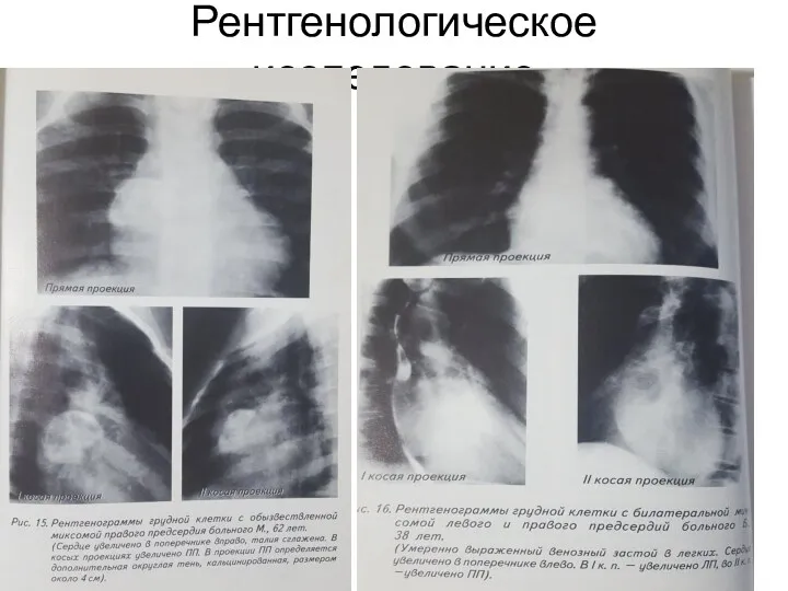 Рентгенологическое исследование