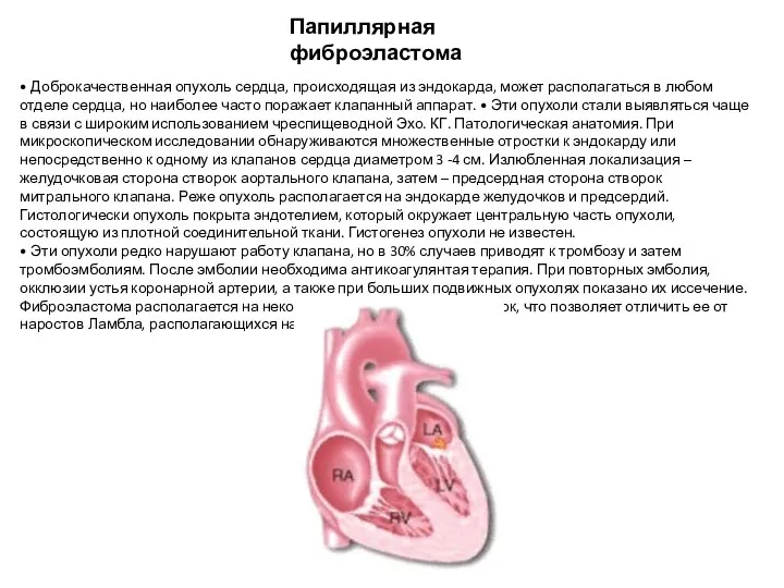Папиллярная фиброэластома • Доброкачественная опухоль сердца, происходящая из эндокарда, может