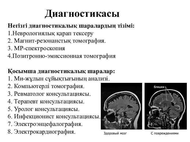 Диагностикасы Негізгі диагностикалық шаралардың тізімі: 1.Неврологиялық қарап тексеру 2. Магнит-резонанстық томография. 3. МР-спектроскопия