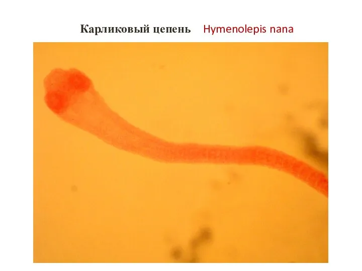 Карликовый цепень Hymenolepis nana