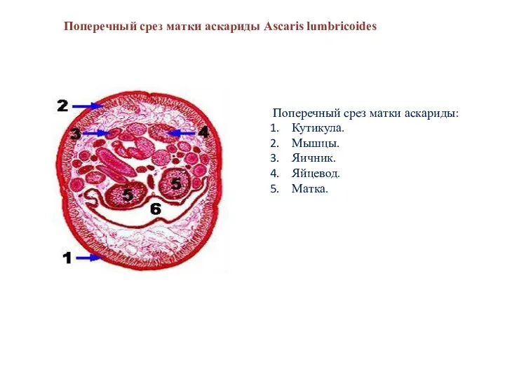 Поперечный срез матки аскариды: Кутикула. Мышцы. Яичник. Яйцевод. Матка. Поперечный срез матки аскариды Ascaris lumbricoides