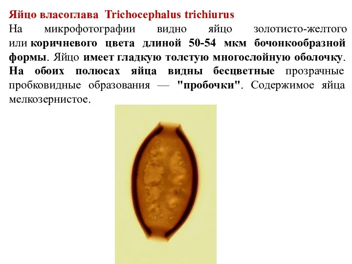 Яйцо власоглава Trichocephalus trichiurus На микрофотографии видно яйцо золотисто-желтого или коричневого цвета длиной
