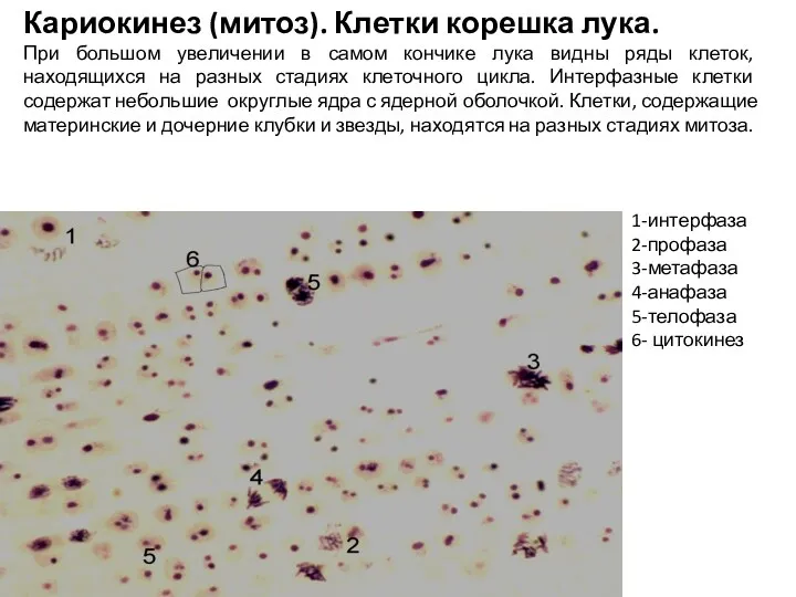 Кариокинез (митоз). Клетки корешка лука. При большом увеличении в самом кончике лука видны