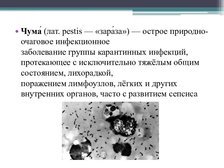 Чума́ (лат. pestis — «зара́за») — острое природно-очаговое инфекционное заболевание