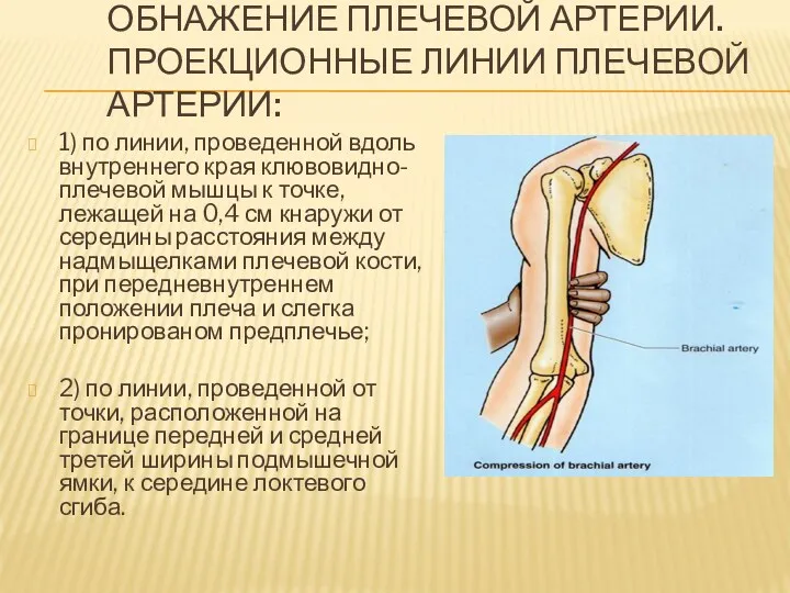 ОБНАЖЕНИЕ ПЛЕЧЕВОЙ АРТЕРИИ. ПРОЕКЦИОННЫЕ ЛИНИИ ПЛЕЧЕВОЙ АРТЕРИИ: 1) по линии, проведенной вдоль внутреннего