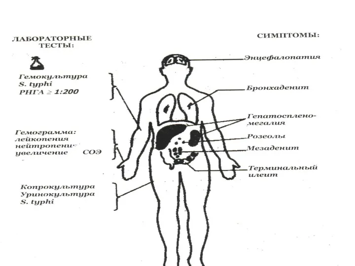 КЛИНИЧЕСКИЕ ПРОЯВЛЕНИЯ