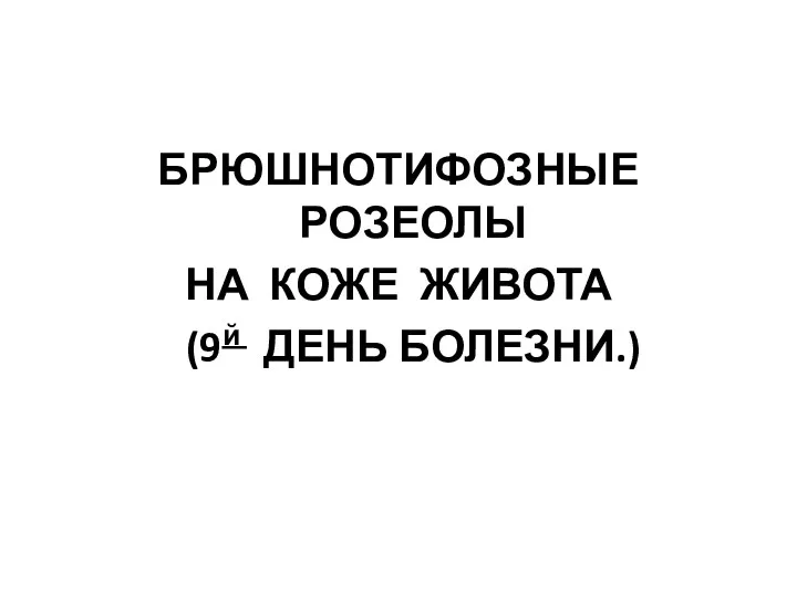 БРЮШНОТИФОЗНЫЕ РОЗЕОЛЫ НА КОЖЕ ЖИВОТА (9й ДЕНЬ БОЛЕЗНИ.)