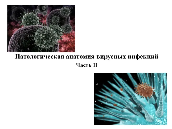 Патологическая анатомия вирусных инфекций Часть II