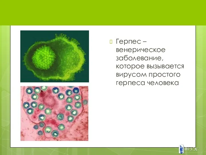 ГЕРПЕС Герпес – венерическое заболевание, которое вызывается вирусом простого герпеса человека