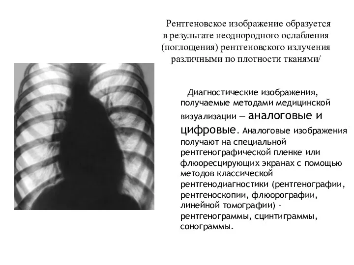 Рентгеновское изображение образуется в результате неоднородного ослабления (поглощения) рентгеновского излучения