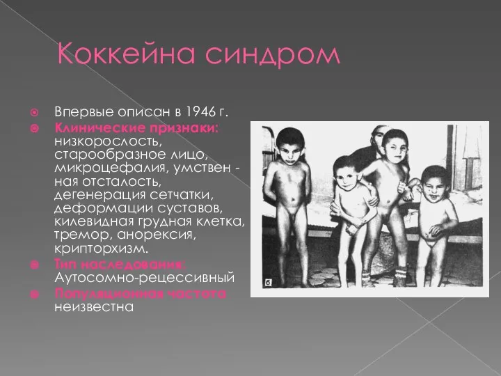 Коккейна синдром Впервые описан в 1946 г. Клинические признаки: низкорослость, старообразное лицо, микроцефалия,