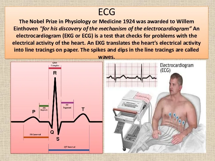 ECG The Nobel Prize in Physiology or Medicine 1924 was