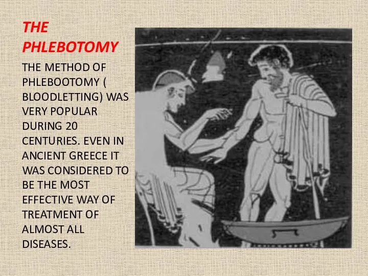 THE PHLEBOTOMY THE METHOD OF PHLEBOOTOMY ( BLOODLETTING) WAS VERY