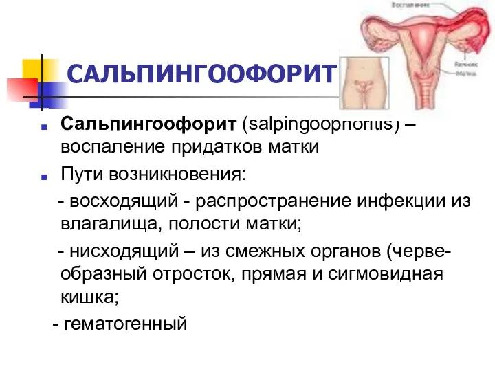 САЛЬПИНГООФОРИТ Сальпингоофорит (salpingoophoritis) – воспаление придатков матки Пути возникновения: -