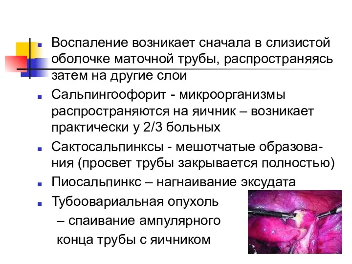 Воспаление возникает сначала в слизистой оболочке маточной трубы, распространяясь затем