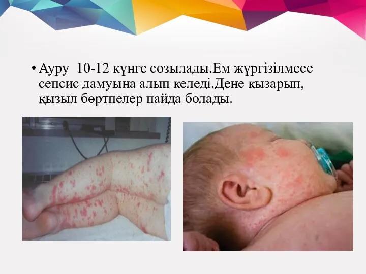 Ауру 10-12 күнге созылады.Ем жүргізілмесе сепсис дамуына алып келеді.Дене қызарып,қызыл бөртпелер пайда болады.